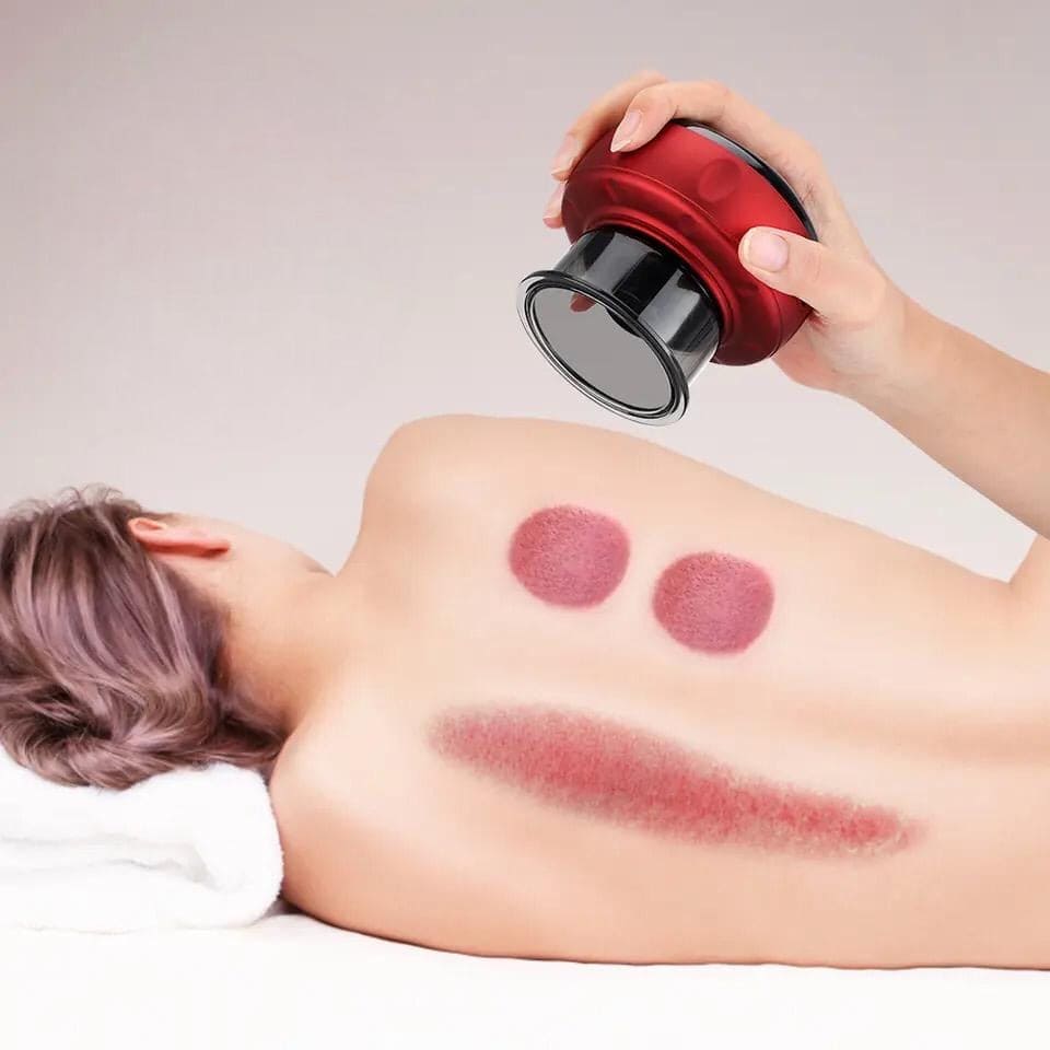 Electric Cupping Massager, Anti Cellulite Wireless Massager, 3 In 1 Electric Handheld Dynamic Suction Massager, Electric Anti Cellulite Suction Cup, Vacuum Cupping Massager, Guasha Scraping Fat Burner Device